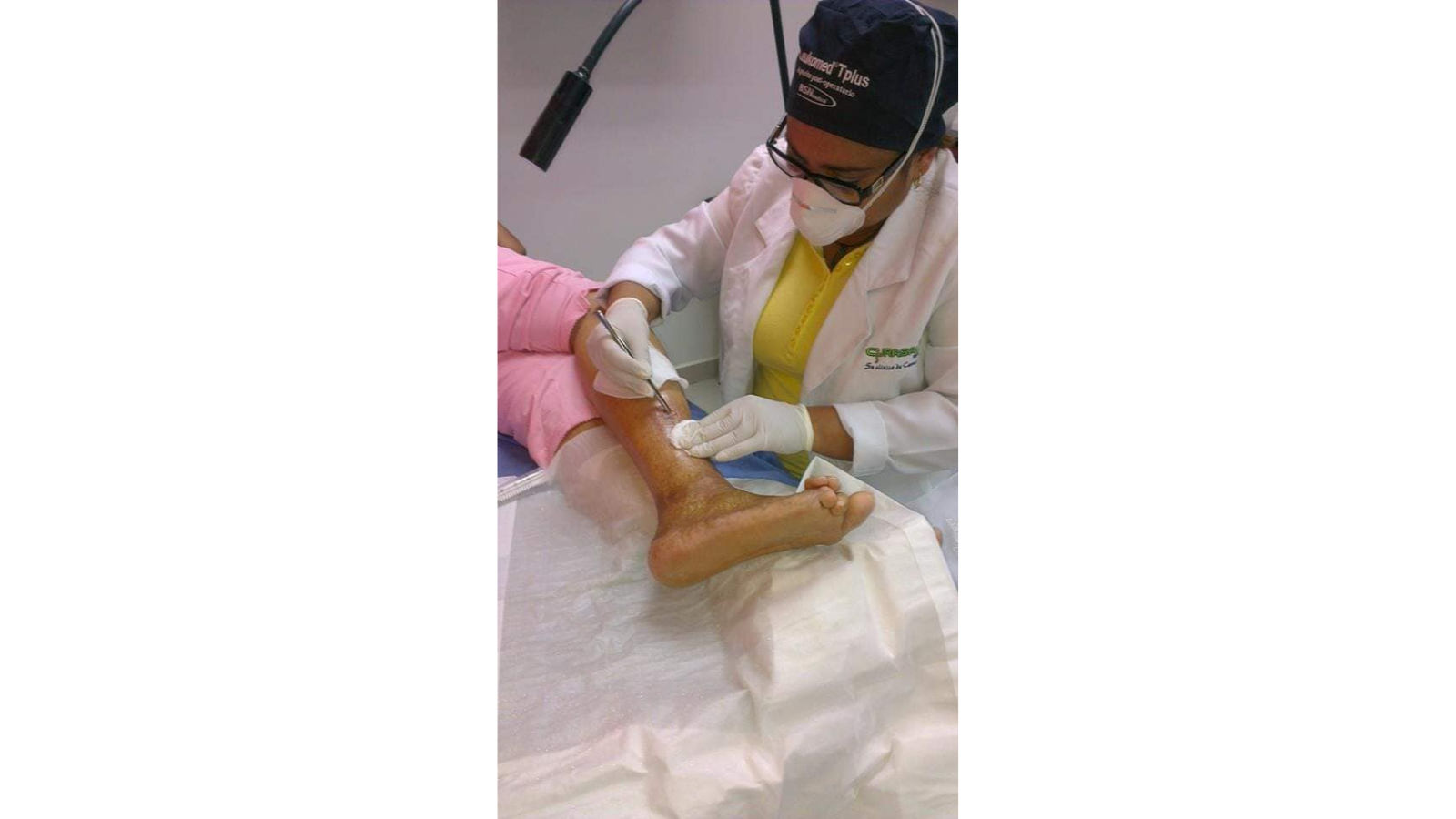 Odra Velásquez, el camino de una venezolana que creó una sandalia inteligente para prevenir amputaciones por diabetes